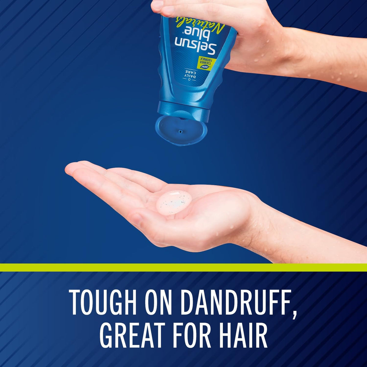 Selsun Blue Shampoo Antipelliculaire 11 oz bouteille vue latérale