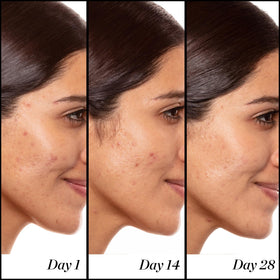 Sérum Anti-Âge A+ Sunday Riley avec application sur le visage