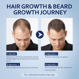 Sérum Artimore 5% Minoxidil sur un fond neutre