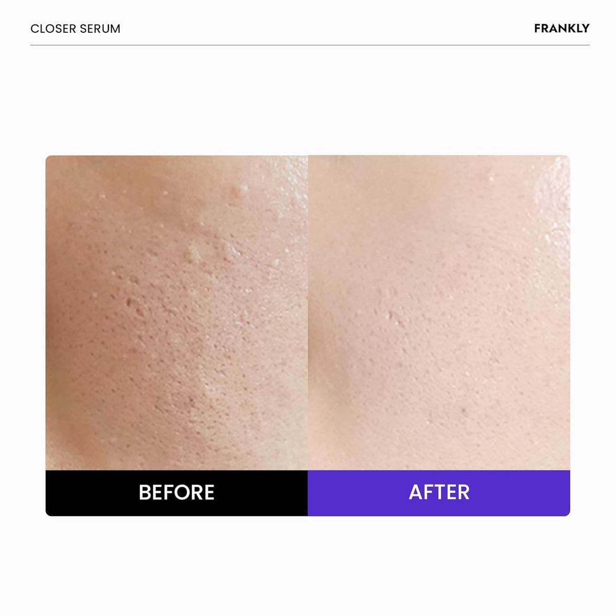 Sérum Closer Jumbo FRANKLY 2,03 fl oz vue arrière avec ingrédients
