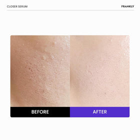 Sérum Closer Jumbo FRANKLY 2,03 fl oz vue arrière avec ingrédients