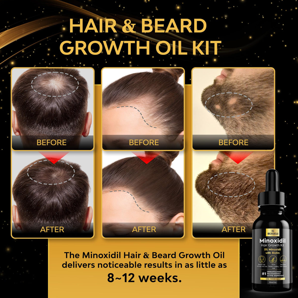 Sérum de croissance de barbe beaueli en format flacon