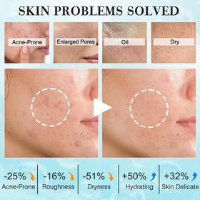 Sérum et crème du kit de soins de la peau FITOEG
