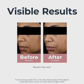 Sérum Eucerin en application sur le visage