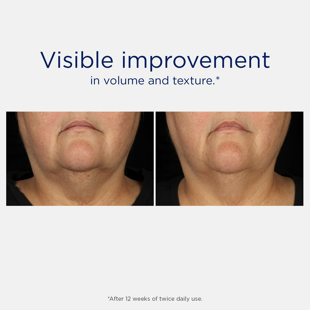 Sérum Lifting Tri-Therapy NEOSTRATA dans son emballage