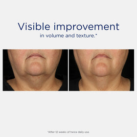 Sérum Lifting Tri-Therapy NEOSTRATA dans son emballage