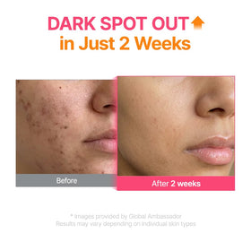 Sérum PURITO TXA 6% + Niacinamide en utilisation quotidienne