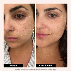 Sérum Retinol Remix 1% Innbeauty Project avec une texture légère