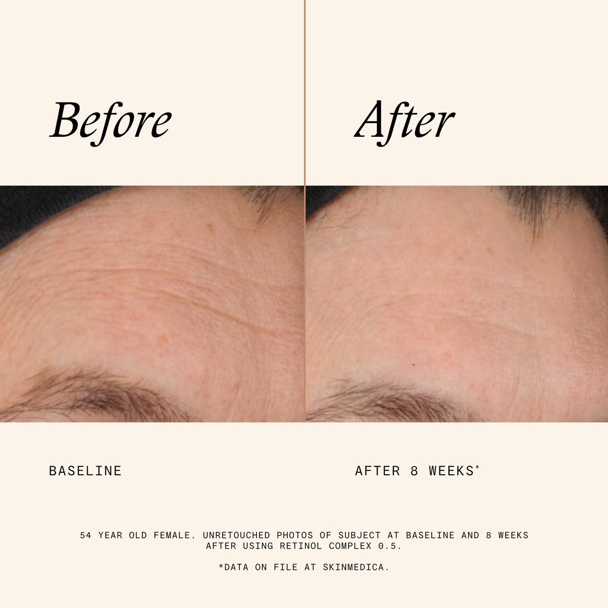 Sérum SkinMedica Retinol 0,5 Complex en ambiance de salle de bain