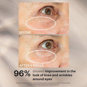 Sérum StriVectin Peptight® à côté d'autres soins de beauté