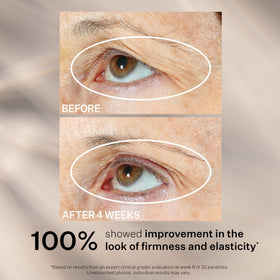 Sérum StriVectin Peptight® avec vue rapprochée des ingrédients