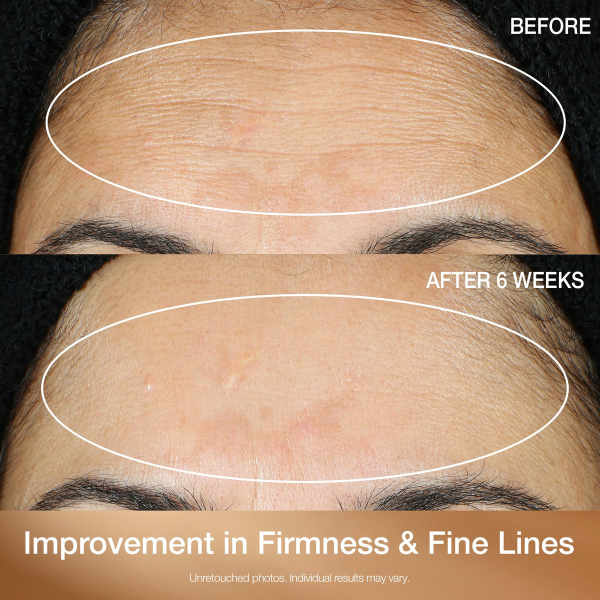 Sérum StriVectin Super-C Retinol appliqué sur la peau