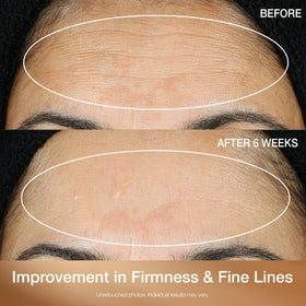 Sérum StriVectin Super-C Retinol appliqué sur la peau