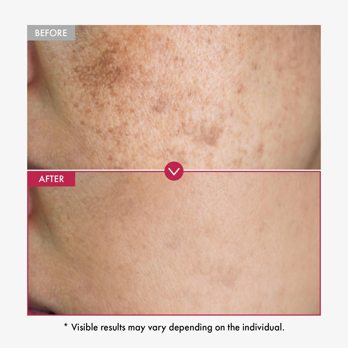 Sérum TOSOWOONG Niacinamide 10% ingrédients clés sur fond blanc
