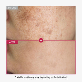 Sérum TOSOWOONG Niacinamide 10% ingrédients clés sur fond blanc