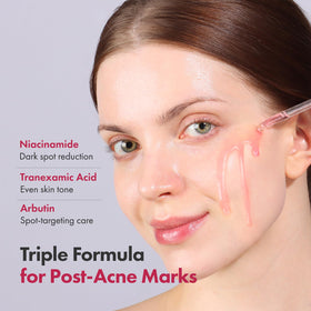 Sérum TOSOWOONG Niacinamide 10% texture légère sur la main