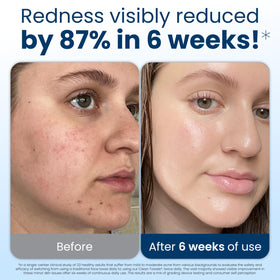 Serviettes CLEAN SKIN CLUB dans un bagage à main, prêtes pour le voyage