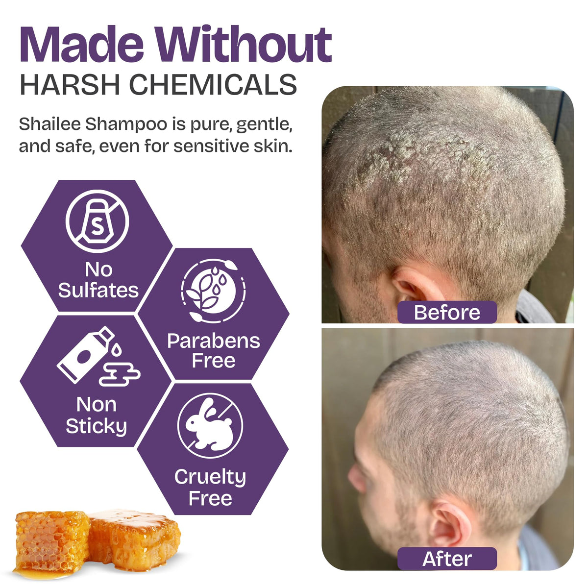 Shailee Shampoo psoriasis 240g - texture du produit
