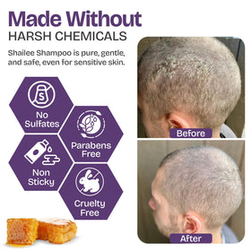 Shailee Shampoo psoriasis 240g - texture du produit