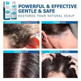 Shampooing Roycederm 331g avec accessoires de soin capillaire