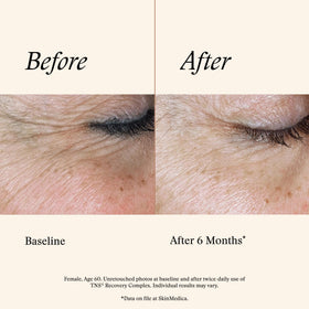 SkinMedica TNS Recovery Complex 200g en gros plan sur la texture