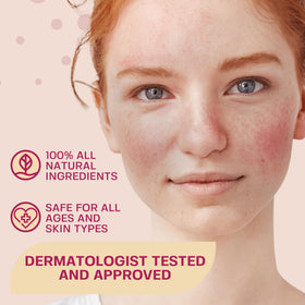Spray Acide Hypochloreux BASE LABORATORIES en utilisation sur le visage