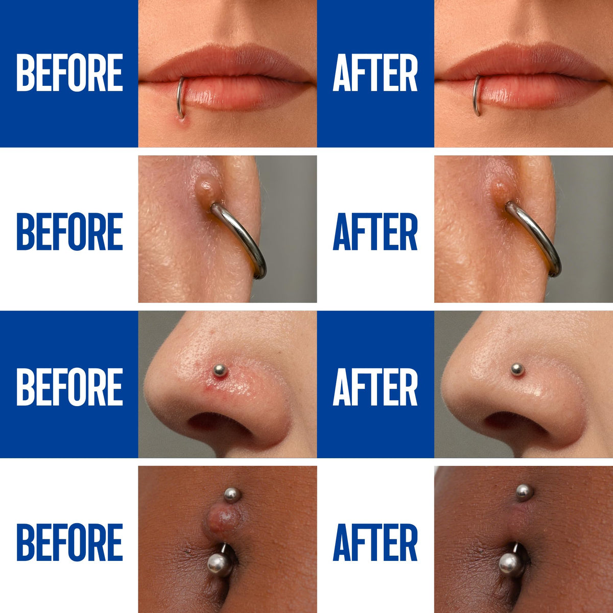 Spray après-piercing BodyJ4You en usage sur un piercing d'oreille