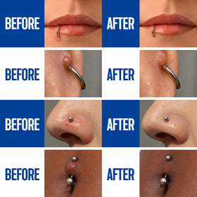 Spray après-piercing BodyJ4You en usage sur un piercing d'oreille