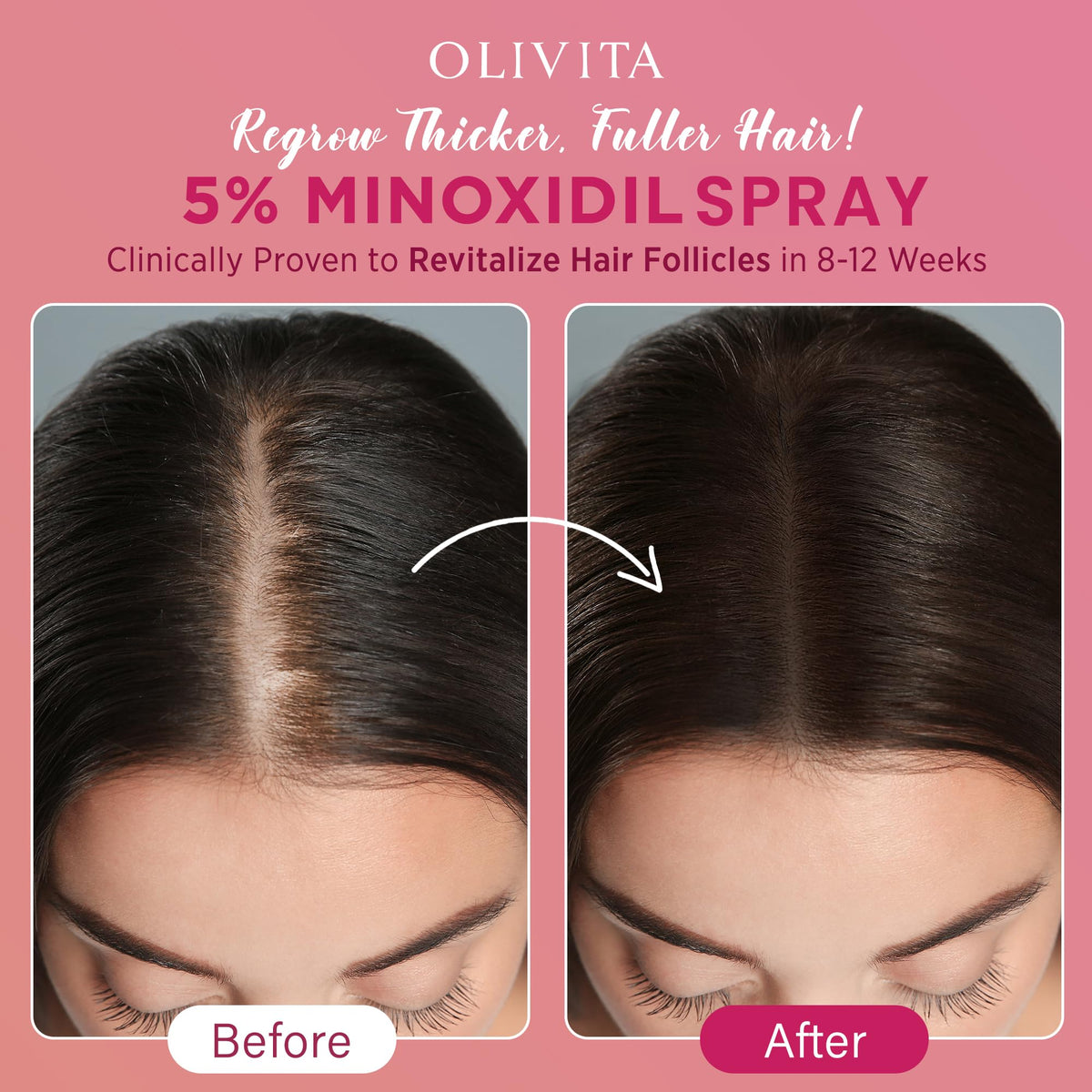 Spray OLIVITA 5% Minoxidil, packaging avec 2 flacons
