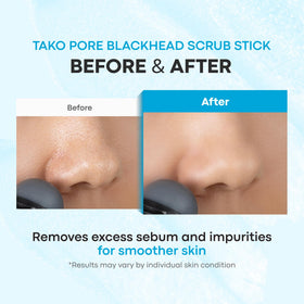 Stick exfoliant TONYMOLY Tako Pore sur fond blanc