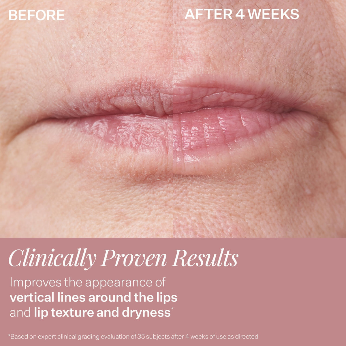 StriVectin DoubleFix® pour les lèvres 30g effet brillant sur les lèvres