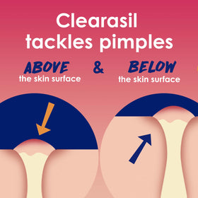 Tampons Clearasil avec acide salicylique 2%