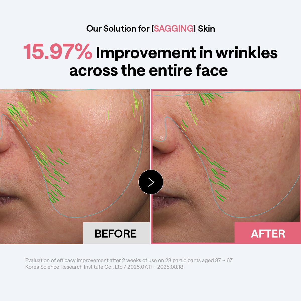 Tampons MEDIHEAL Retinol & Peptides dans un environnement de soins de la peau