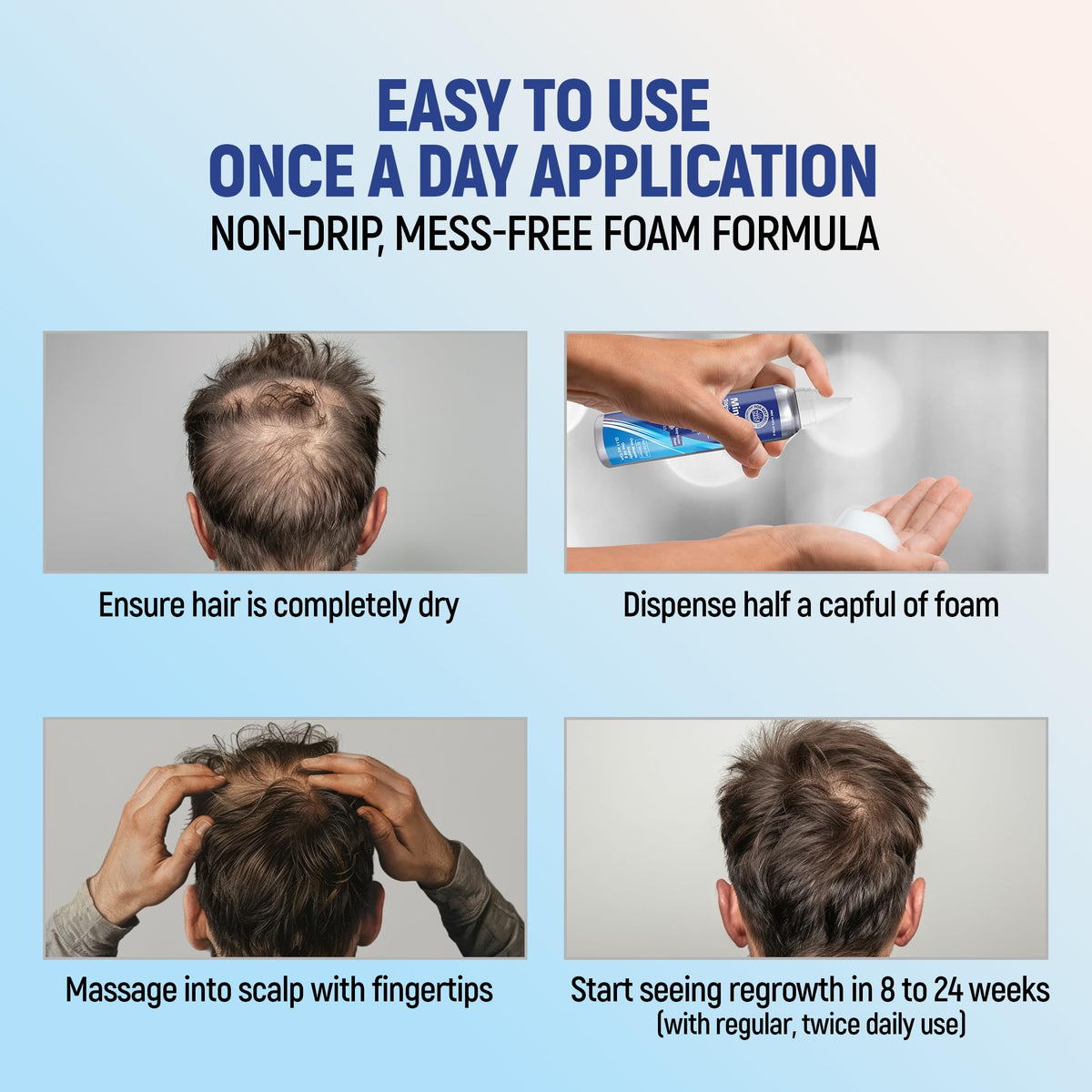 TARO Minoxidil 5% Mousse Topique en utilisation quotidienne