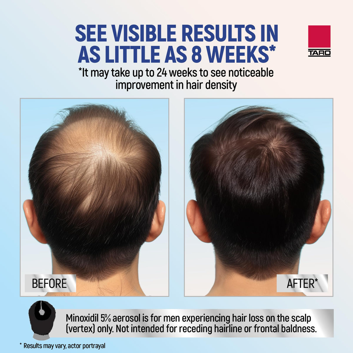 TARO Minoxidil Mousse 5% flacon à l'arrière