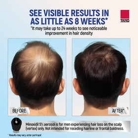 TARO Minoxidil Mousse 5% flacon à l'arrière