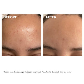 Texture crémeuse du CLARINS Beauty Flash Peel sur une main