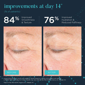 Texture de la crème contour des yeux NEOCUTIS Lumiere Firm Riche