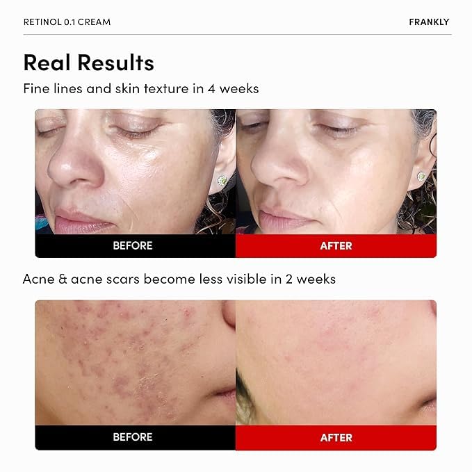 Texture de la crème de rétinol 0,1% de FRANKLY sur une main