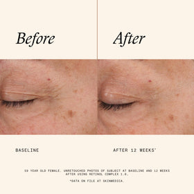 Texture du Sérum SkinMedica Retinol 1.0 Complex sur la main