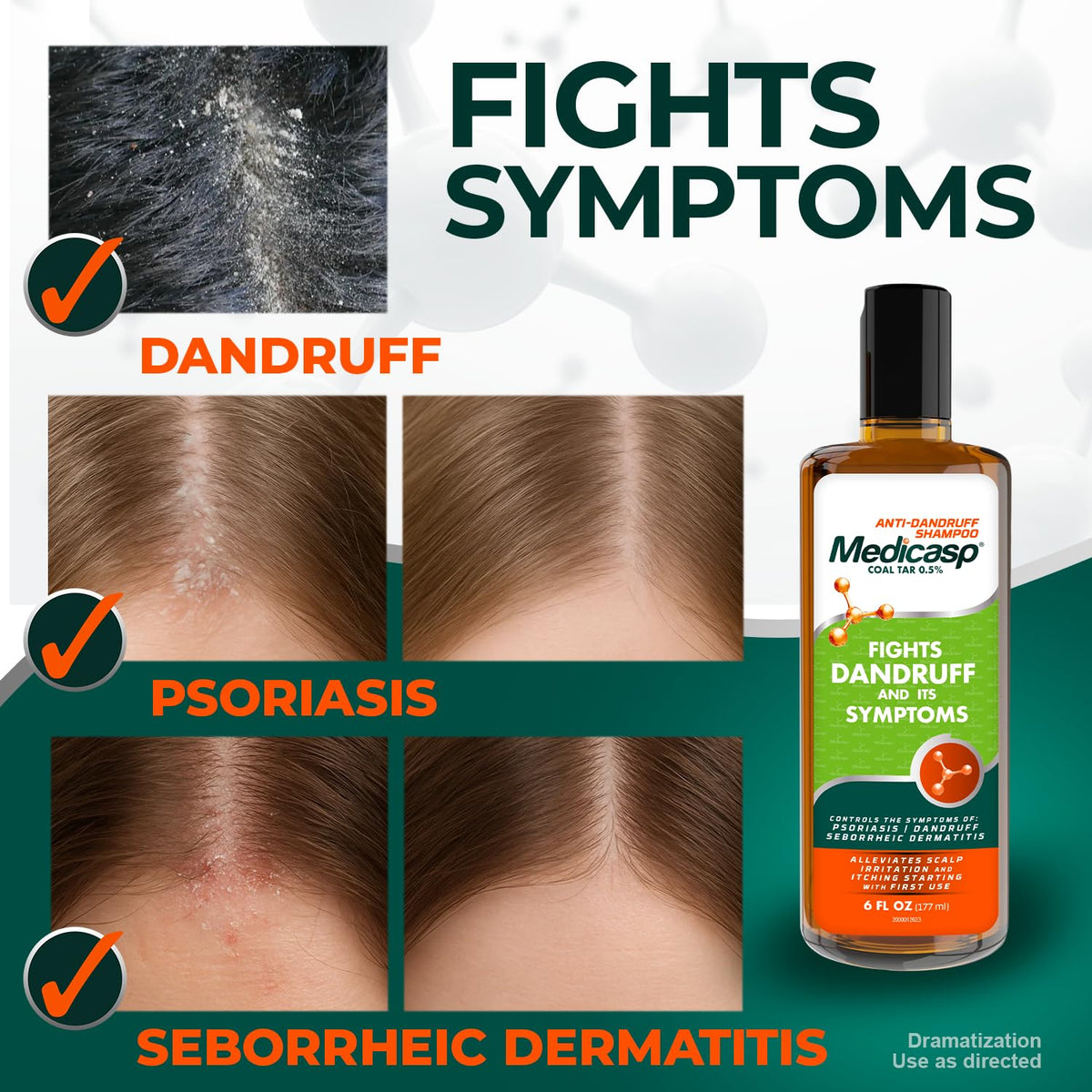 Texture du shampooing anti-pelliculaire Medicasp sur la main