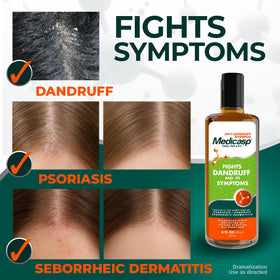 Texture du shampooing anti-pelliculaire Medicasp sur la main