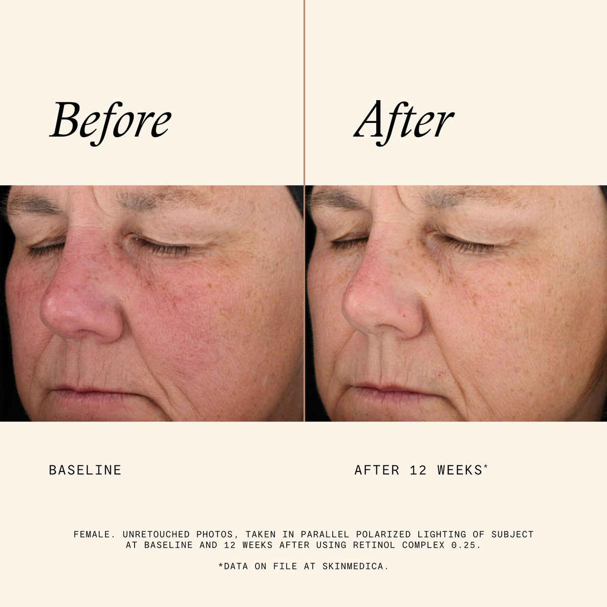 Texture du SkinMedica Serum de Rétinol 0,25 Complex