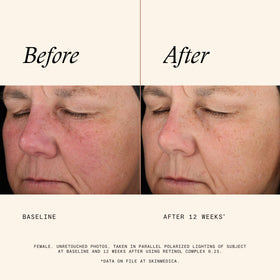 Texture du SkinMedica Serum de Rétinol 0,25 Complex
