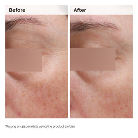 The Ordinary Émulsion Niacinamide 5% 130g dans un cadre de soins de la peau