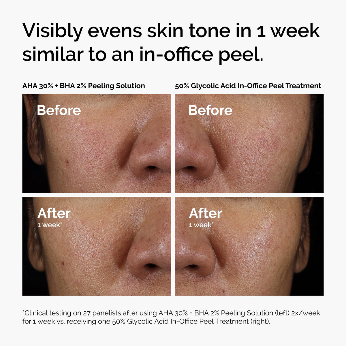 The Ordinary Peeling Solution AHA 30% + BHA 2% packaging avec ingrédients
