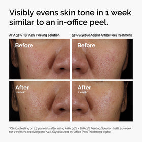 The Ordinary Peeling Solution AHA 30% + BHA 2% packaging avec ingrédients
