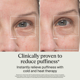 TheraFace Depuffing Wand en utilisation sur le contour des yeux