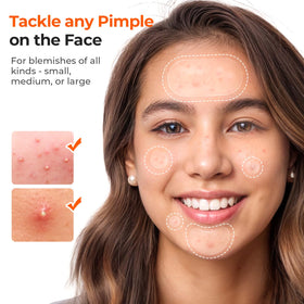 TKTK patch hydrocolloïde de 10 mm en gros plan