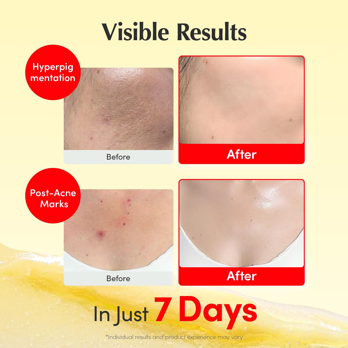 Utilisation de la crème EQQUALBERRY sur le visage